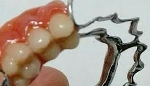 Ex ataca homem com dentadura em motel